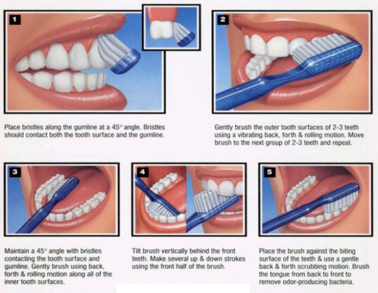 Instructions image on Brushing your Teeth