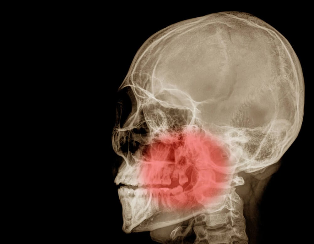 X-ray of a human skull.