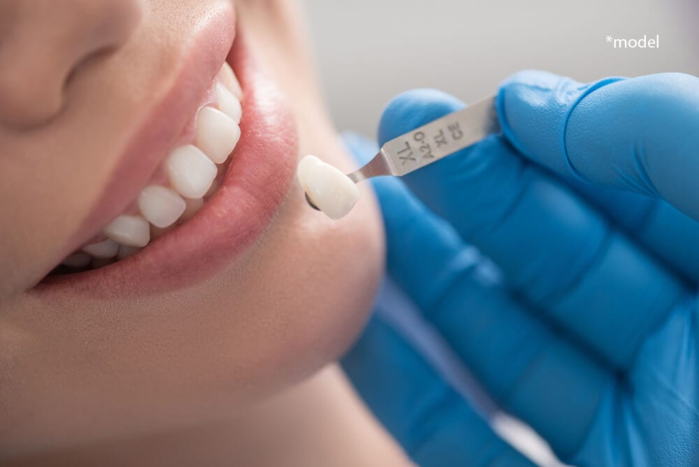 Woman with crown being held up next to tooth for reference.