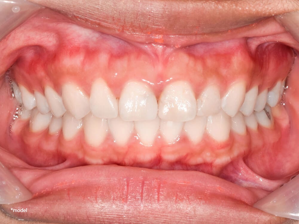 Inside view of a mouth and gums.