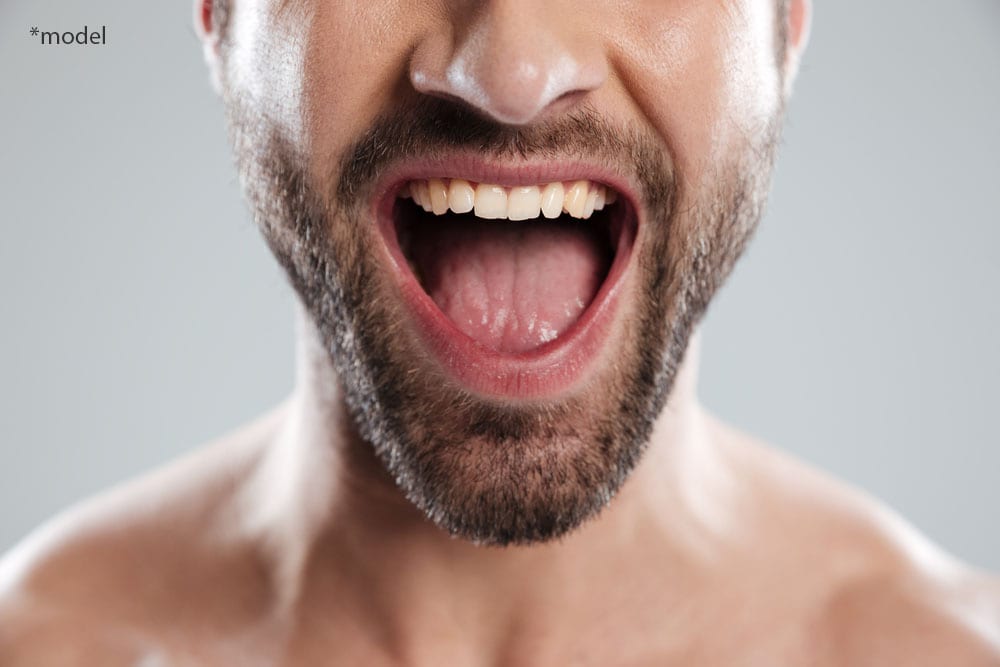 Man opening mouth to show teeth and tongue.