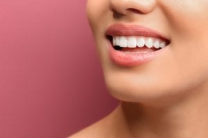 Young woman with healthy teeth laughing