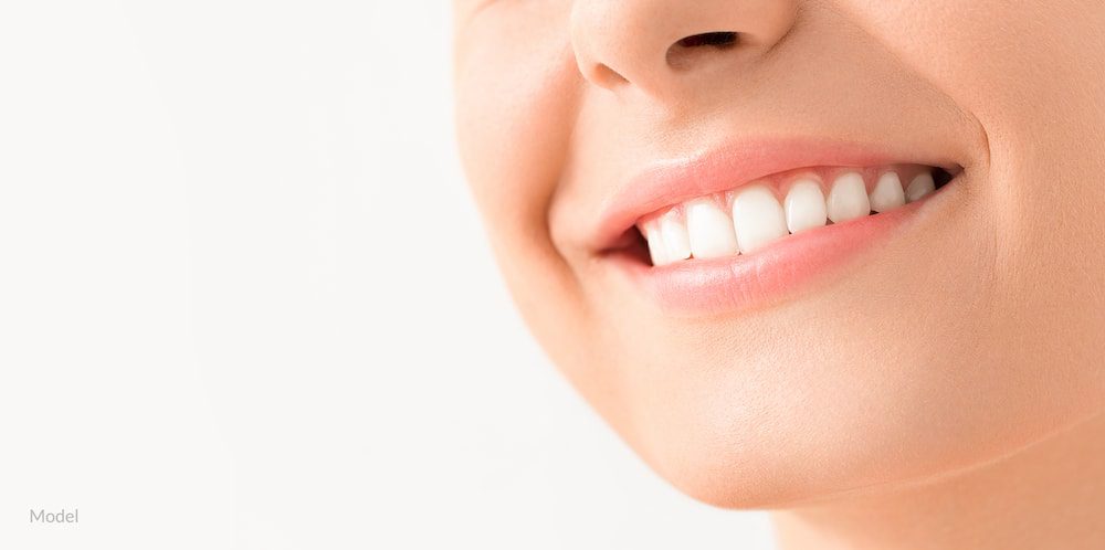 Woman smiling with healthy, white teeth and no signs of periodontal disease.