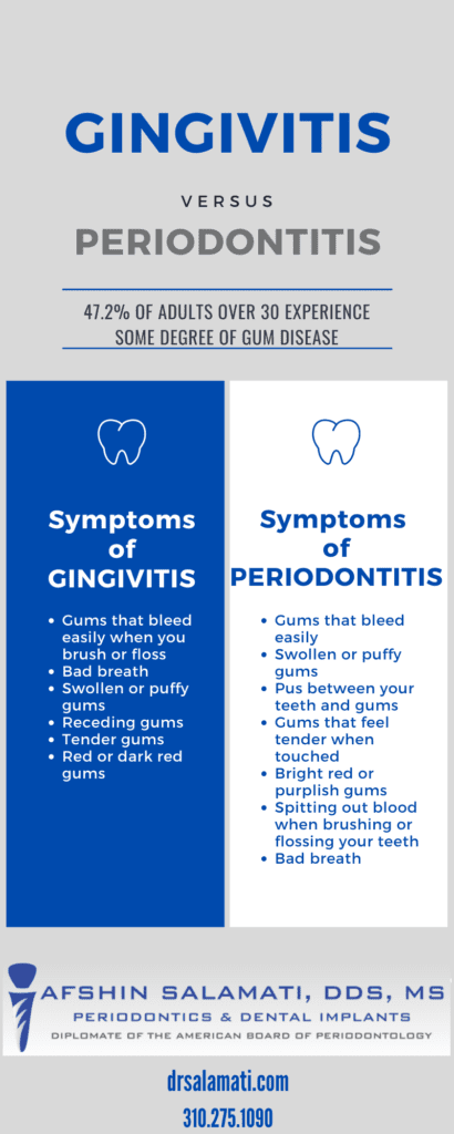 Infographic explaining the differences between gingivitis and periodontitis