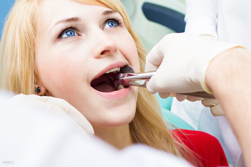 Woman getting tooth pulled at dentist.