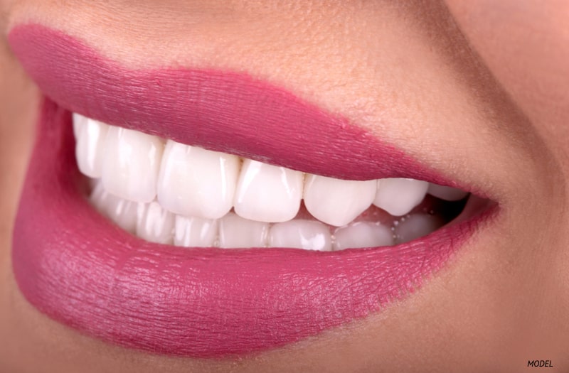 Close-up of white smile with pink lips