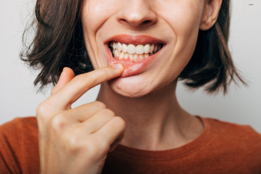 woman with inflamed gums pushing her lip down