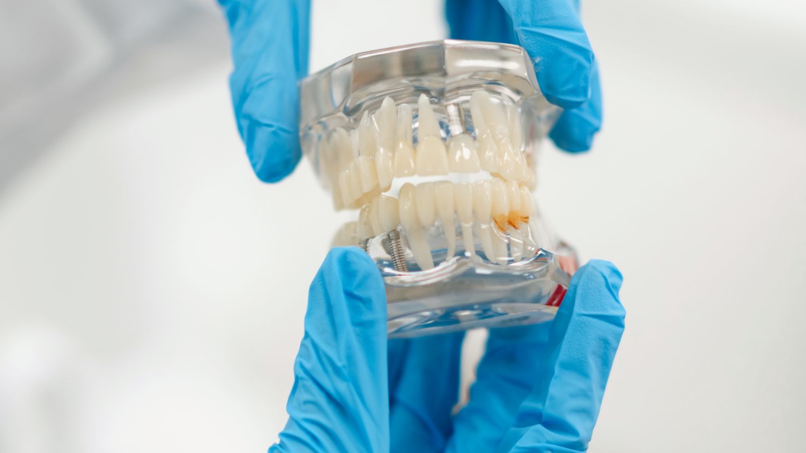 gloved hands holding a transparent anatomical model of human teeth, demonstrating the structure of healthy gums and teeth